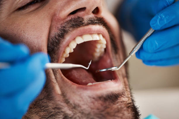 Emergency Dental Services in Reliez Valley, CA